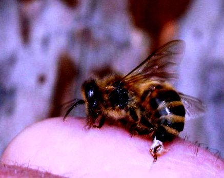 Bee stings swelling (3)